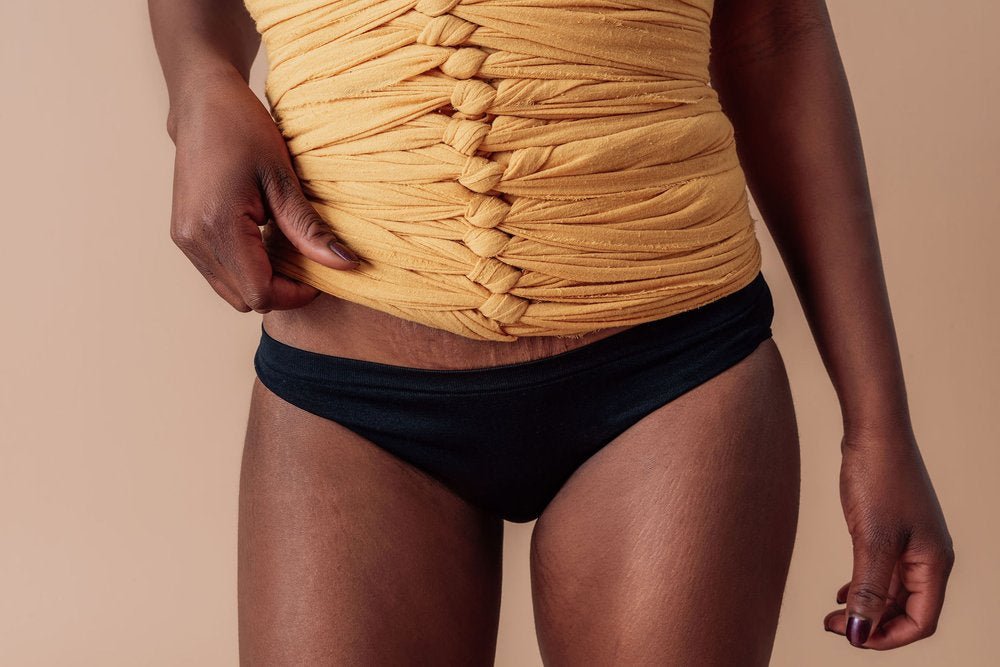 Bellibind Basics - BellibindBellibind